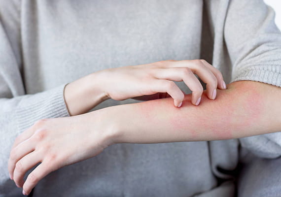 じんま疹やアトピー性皮膚炎を得意とする皮膚科